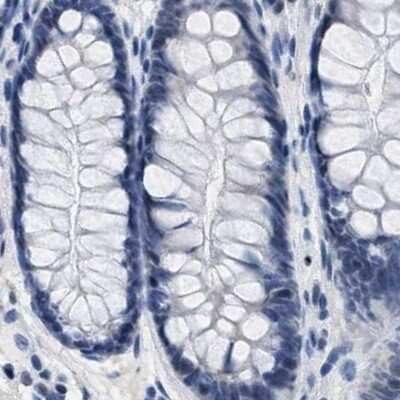 Immunohistochemistry-Paraffin: Boll Antibody [NBP1-88377]