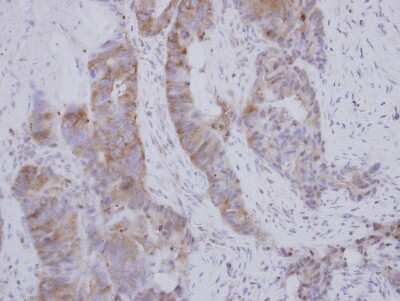 Immunohistochemistry-Paraffin: Boll Antibody [NBP2-15603]