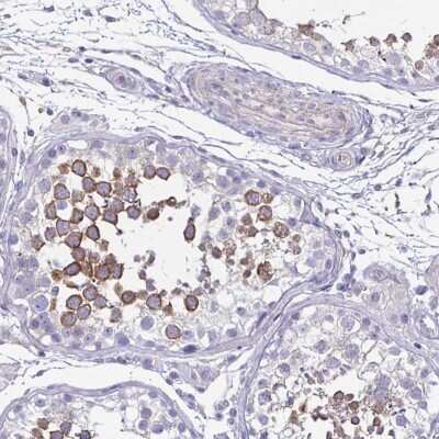 Immunohistochemistry-Paraffin: Boll Antibody [NBP2-33538]