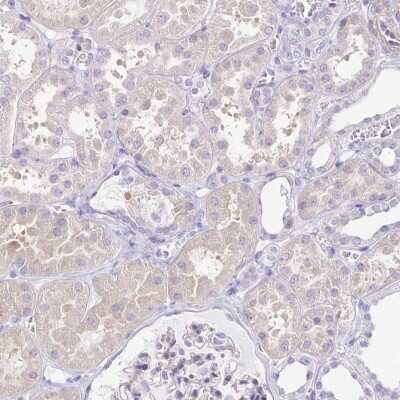 Immunohistochemistry-Paraffin: Boll Antibody [NBP2-33538]