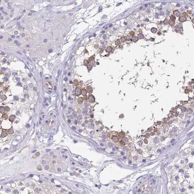 Immunohistochemistry-Paraffin: Boll Antibody [NBP2-33538]
