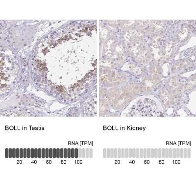 Immunohistochemistry-Paraffin: Boll Antibody [NBP2-33538]
