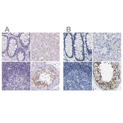 Immunohistochemistry-Paraffin: Boll Antibody [NBP2-33538]