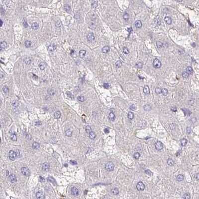 Immunohistochemistry-Paraffin: Boll Antibody [NBP2-33538]