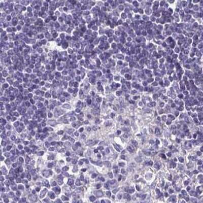 Immunohistochemistry-Paraffin: Boll Antibody [NBP2-33538]