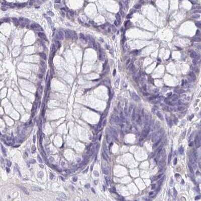Immunohistochemistry-Paraffin: Boll Antibody [NBP2-33538]
