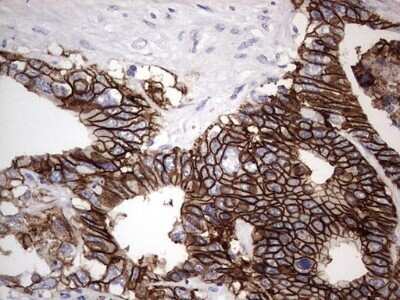 Immunohistochemistry: Boll Antibody (OTI2D11) - Azide and BSA Free [NBP2-72180]