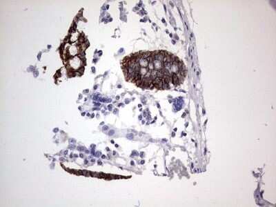 Immunohistochemistry: Boll Antibody (OTI2D11) - Azide and BSA Free [NBP2-72180]