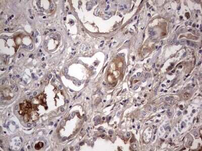 Immunohistochemistry: Boll Antibody (OTI2D11) - Azide and BSA Free [NBP2-72180]