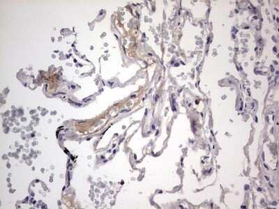 Immunohistochemistry: Boll Antibody (OTI2D11) - Azide and BSA Free [NBP2-72180]