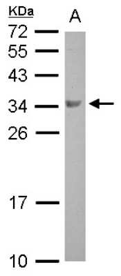 Western Blot: Boll Antibody [NBP2-15603]