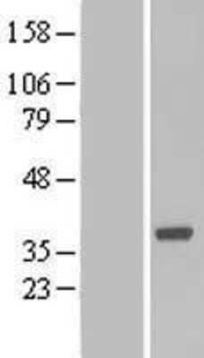 Western Blot: Boll Overexpression Lysate [NBL1-08018]