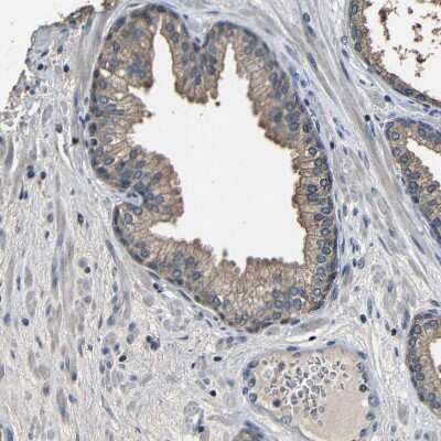 Immunohistochemistry-Paraffin: Bombesin Receptor Activated Protein Antibody [NBP1-93921]