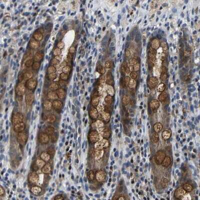 Immunohistochemistry-Paraffin: Bombesin Receptor Activated Protein Antibody [NBP1-93921]