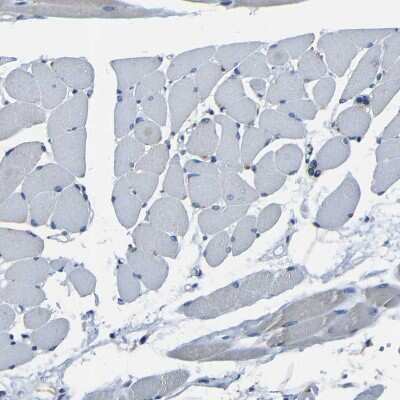 Immunohistochemistry-Paraffin: Bombesin Receptor Activated Protein Antibody [NBP1-93921]