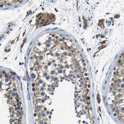 Immunohistochemistry-Paraffin: Bombesin Receptor Activated Protein Antibody [NBP1-93921]