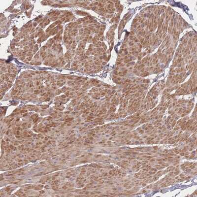 Immunohistochemistry-Paraffin: Bone marrow stromal cell antigen 1/CD157 Antibody [NBP2-14363]