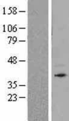 Western Blot: Bone marrow stromal cell antigen 1/CD157 Overexpression Lysate [NBL1-08039]