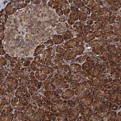 Immunohistochemistry-Paraffin: Bora Antibody [NBP1-89948]