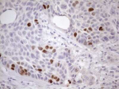 Immunohistochemistry: Borealin Antibody (OTI4G3) [NBP2-46199]