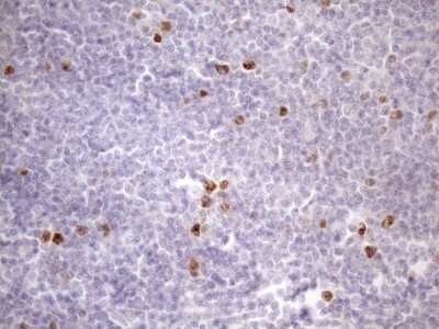 Immunohistochemistry: Borealin Antibody (OTI4G3) [NBP2-46199]