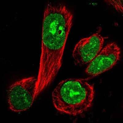 Immunocytochemistry/ Immunofluorescence: Borealin Antibody [NBP1-89951]