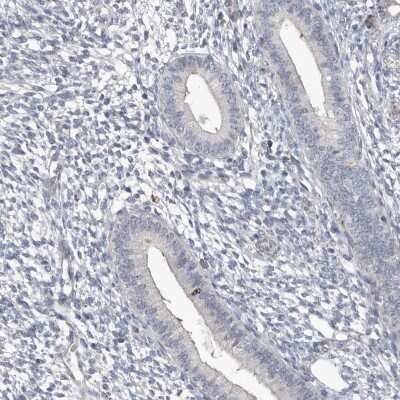 Immunohistochemistry-Paraffin: Borealin Antibody [NBP1-89950]