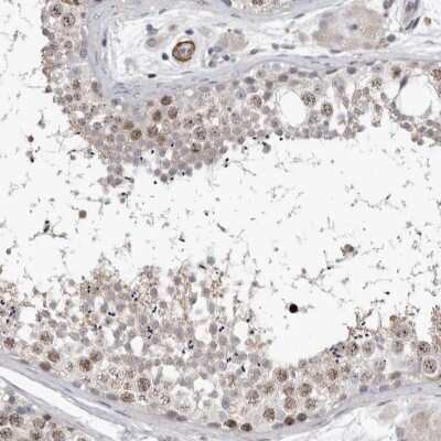 Immunohistochemistry-Paraffin: Borealin Antibody [NBP1-89950]