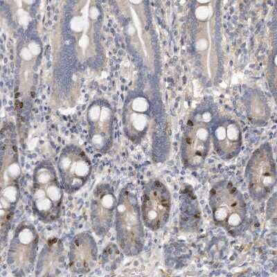 Immunohistochemistry-Paraffin: Borealin Antibody [NBP1-89951]