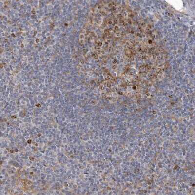 Immunohistochemistry-Paraffin: Borealin Antibody [NBP1-89951]