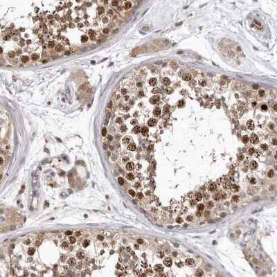 Immunohistochemistry-Paraffin: Borealin Antibody [NBP1-89951]