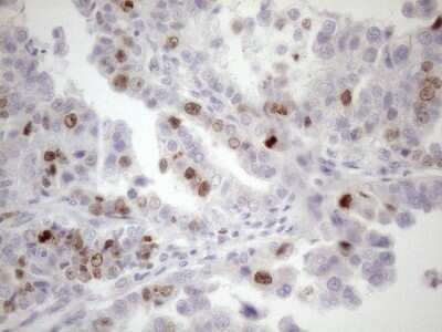 Immunohistochemistry: Borealin Antibody (OTI4G3) - Azide and BSA Free [NBP2-71988]