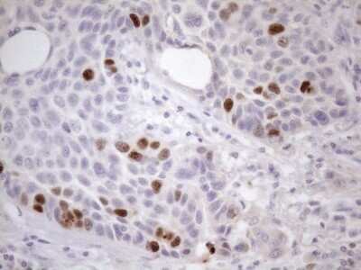 Immunohistochemistry: Borealin Antibody (OTI4G3) - Azide and BSA Free [NBP2-71988]