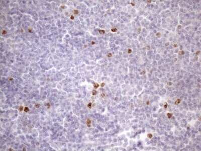 Immunohistochemistry: Borealin Antibody (OTI4G3) - Azide and BSA Free [NBP2-71988]