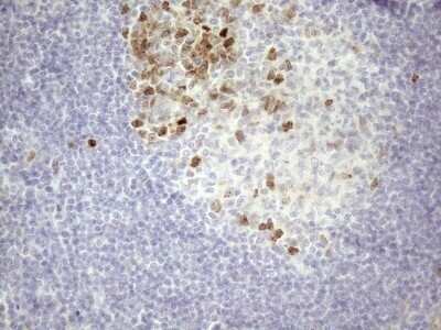 Immunohistochemistry: Borealin Antibody (OTI4G3) - Azide and BSA Free [NBP2-71988]