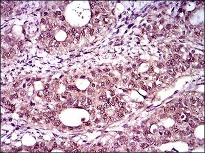 Immunohistochemistry-Paraffin: Brachyury Antibody (1H9A2) - BSA Free [NBP2-37434]