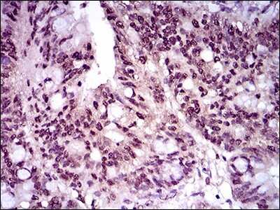 Immunohistochemistry: Brachyury Antibody (1H9A2) - BSA Free [NBP2-37434]