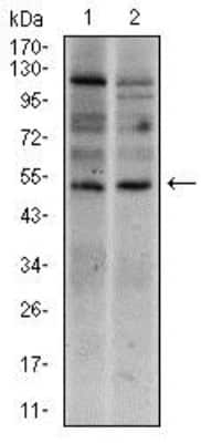 Western Blot: Brachyury Antibody (1H9A2)BSA Free [NBP2-37434]