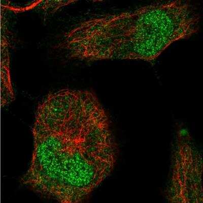 Immunocytochemistry/ Immunofluorescence: Brachyury Antibody [NBP1-87598]