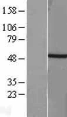 Western Blot: Brachyury Overexpression Lysate [NBL1-16661]