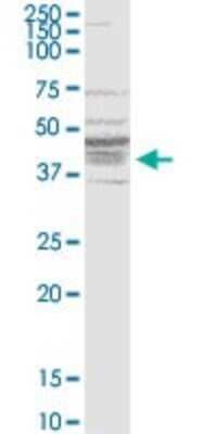 Western Blot: Bradykinin RB1/BDKRB1 Antibody (3A2) [H00000623-M04]