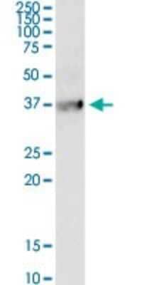 Western Blot: Bradykinin RB1/BDKRB1 Antibody (3A2) [H00000623-M04]