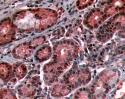 Immunohistochemistry-Paraffin: Bradykinin RB1/BDKRB1 Antibody - BSA Free [NLS3580]