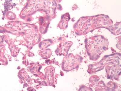 Immunohistochemistry-Paraffin: Bradykinin RB1/BDKRB1 Antibody - BSA Free [NLS3580]