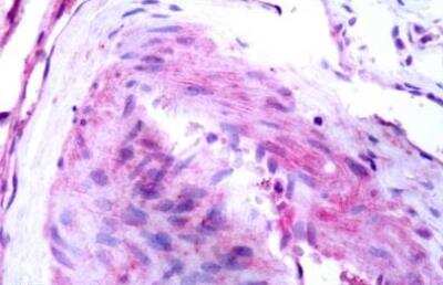 Immunohistochemistry-Paraffin: Bradykinin RB1/BDKRB1 Antibody - BSA Free [NLS3580]