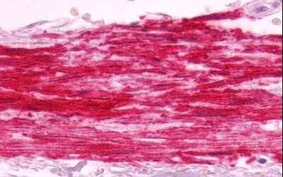 Immunohistochemistry-Paraffin: Bradykinin RB1/BDKRB1 Antibody - BSA Free [NLS799]