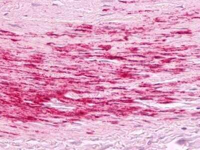 Immunohistochemistry-Paraffin: Bradykinin RB1/BDKRB1 Antibody - BSA Free [NLS799]