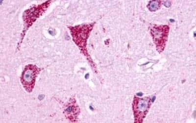 Immunohistochemistry-Paraffin: Bradykinin RB1/BDKRB1 Antibody - BSA Free [NLS799]