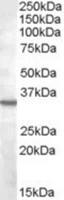 Western Blot: Bradykinin RB1/BDKRB1 Antibody [NB100-96919]