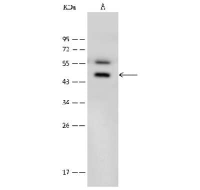 Western Blot: Bradykinin RB1/BDKRB1 Antibody [NBP2-99565]